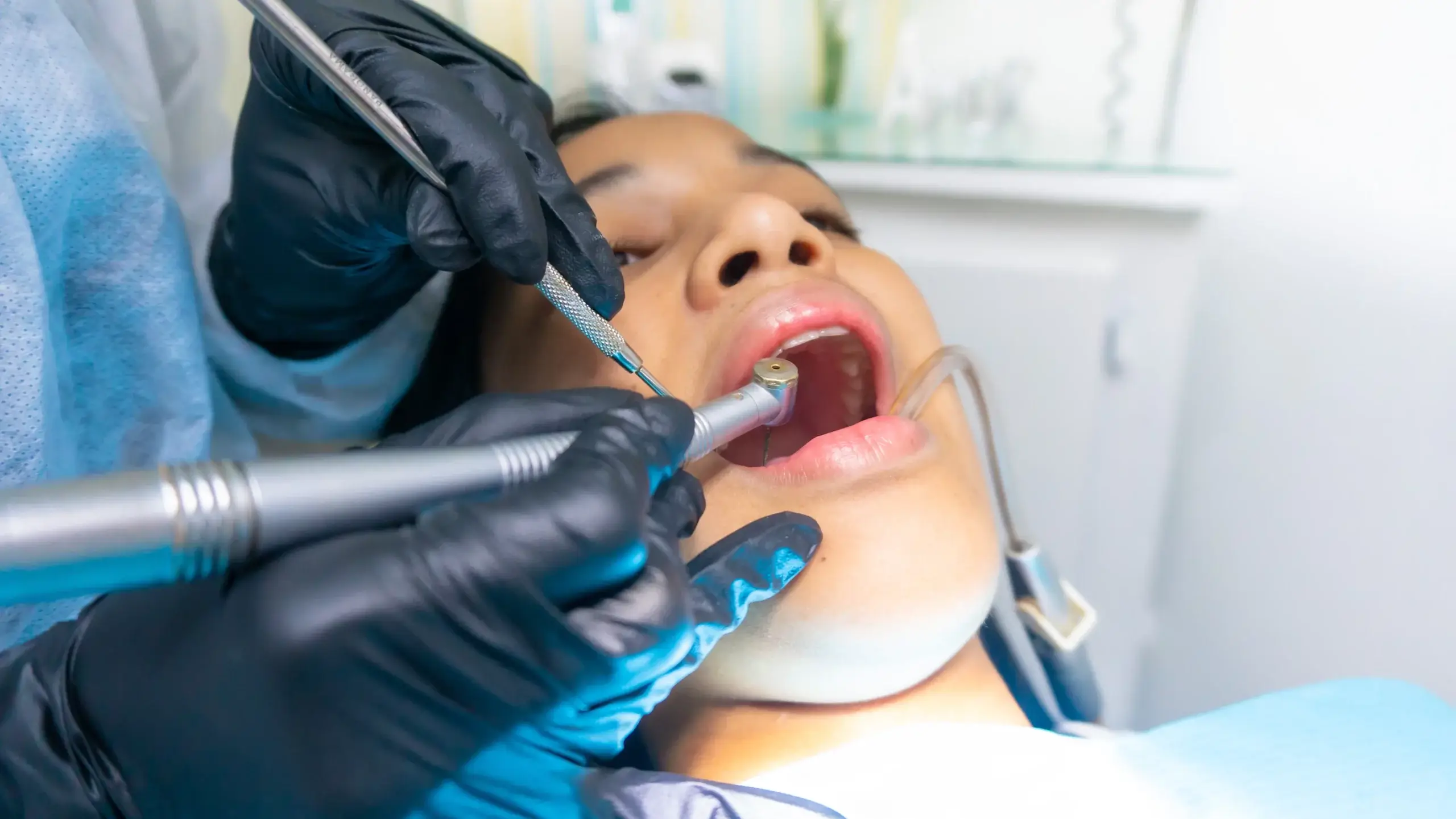 How to Avoid Infection After Wisdom Tooth Removal